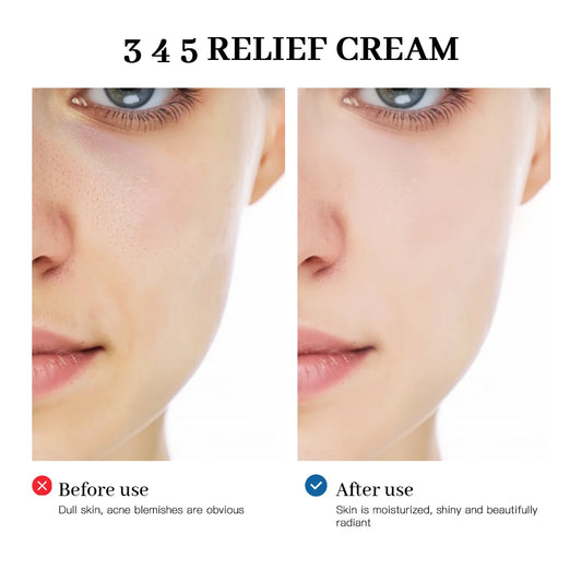 345 Relief Cream